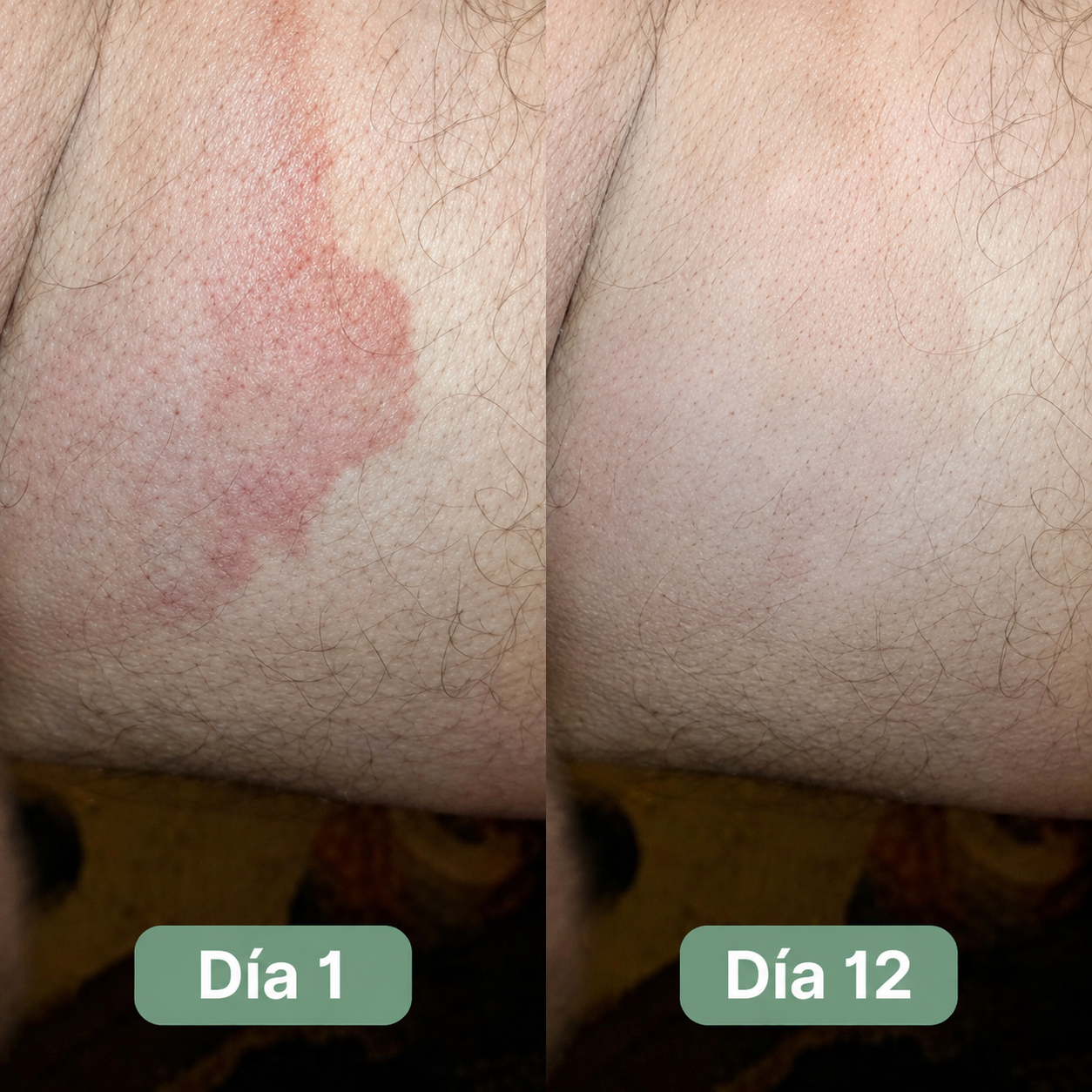 Nolemin® Jabón Antifúngico