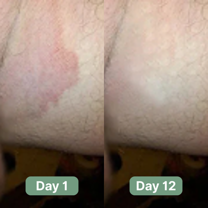 Veloma Antifungal Soap®
