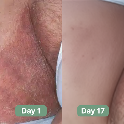 Veloma Antifungal Soap®