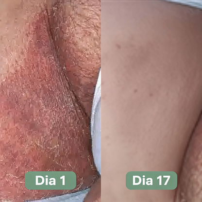 Nolemin® Jabón Antifúngico